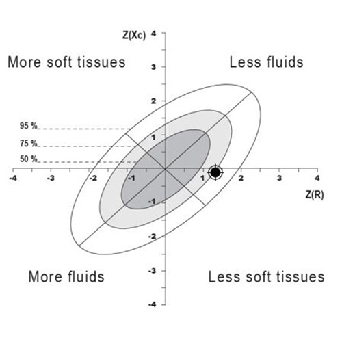 Understanding the BIVA measurement