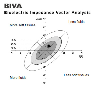 Bioelectrical Impedance Vector Analysis