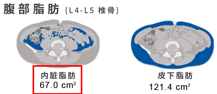 内脏脂肪
