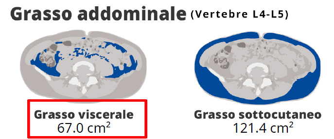 Grasso Viscerale