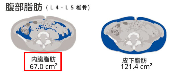 內臟脂肪