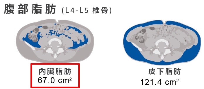 內臟脂肪