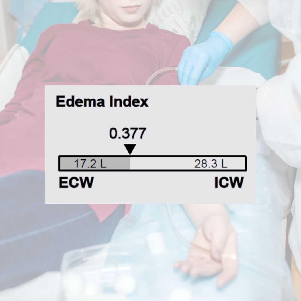 The Importance of Body Composition Analysis for Dialysis